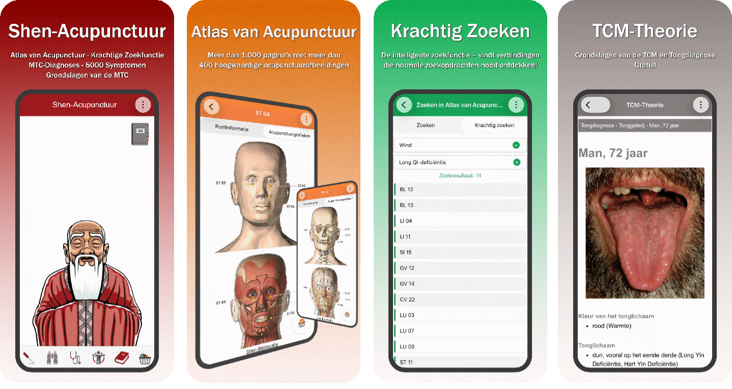 NL-Acupuncture